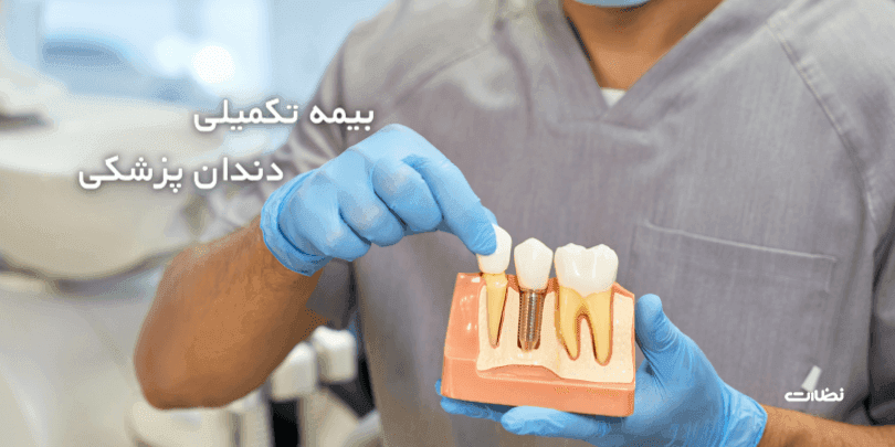 معرفی بهترین بیمه دندانپزشکی انفرادی در مرداد 1403
